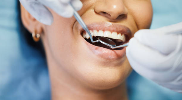 Best Emergency Dental Care for Trauma or Injury in Madera Ranchos, CA