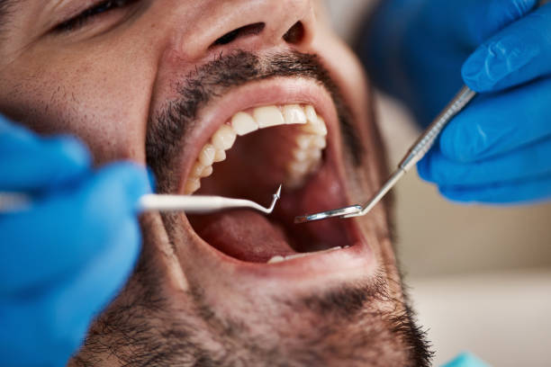Best Emergency Broken Tooth Repair in Madera Ranchos, CA